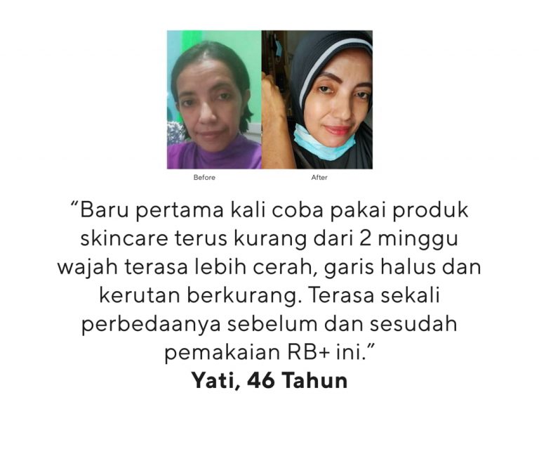 shopee5