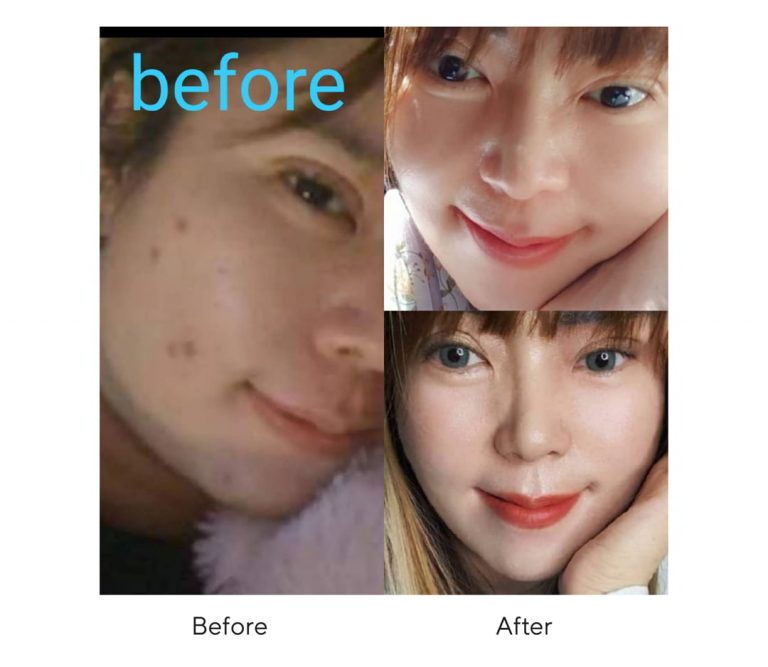 RB landing page-24 edit