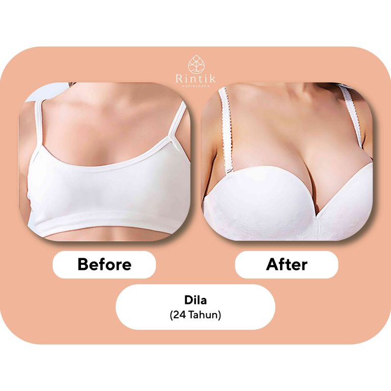 testi before after 2-01