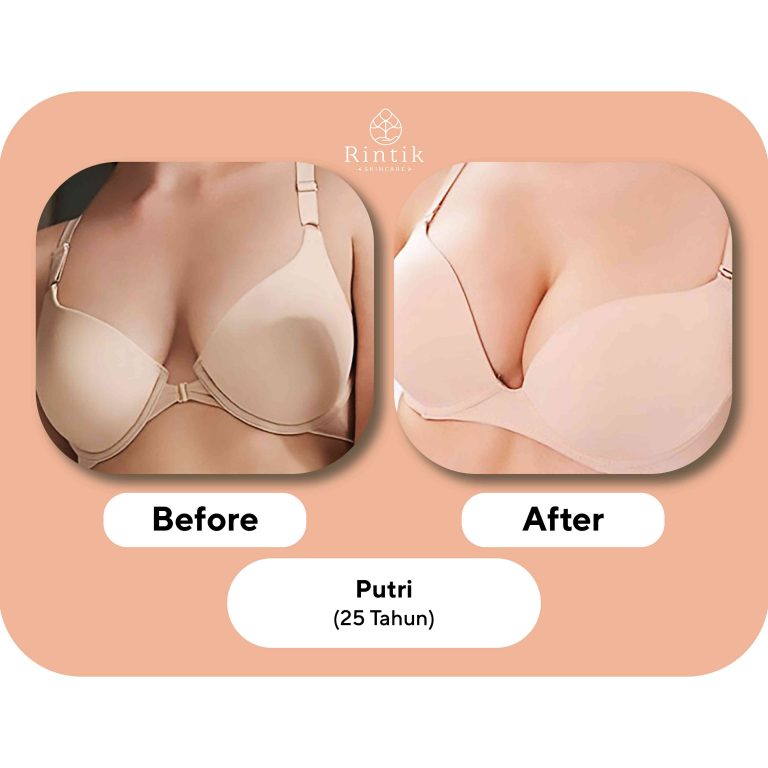 testi before after 3-01