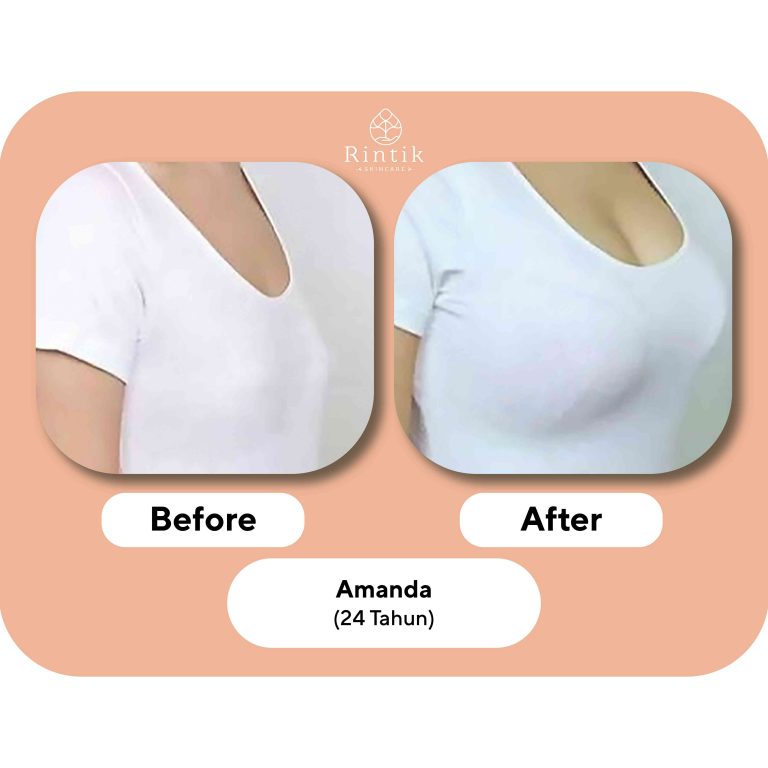 testi before after 4-01