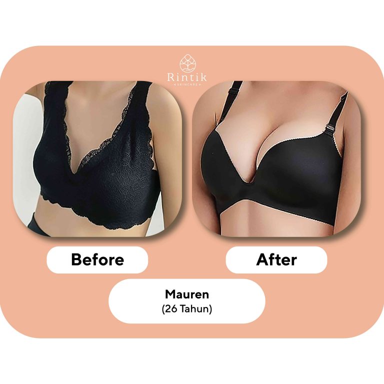 testi before after 5-01